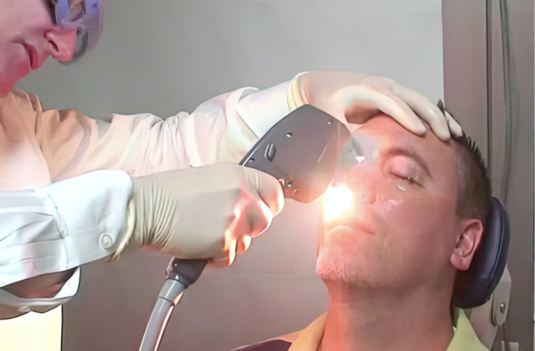 IPL Offers Dry Eye Relief