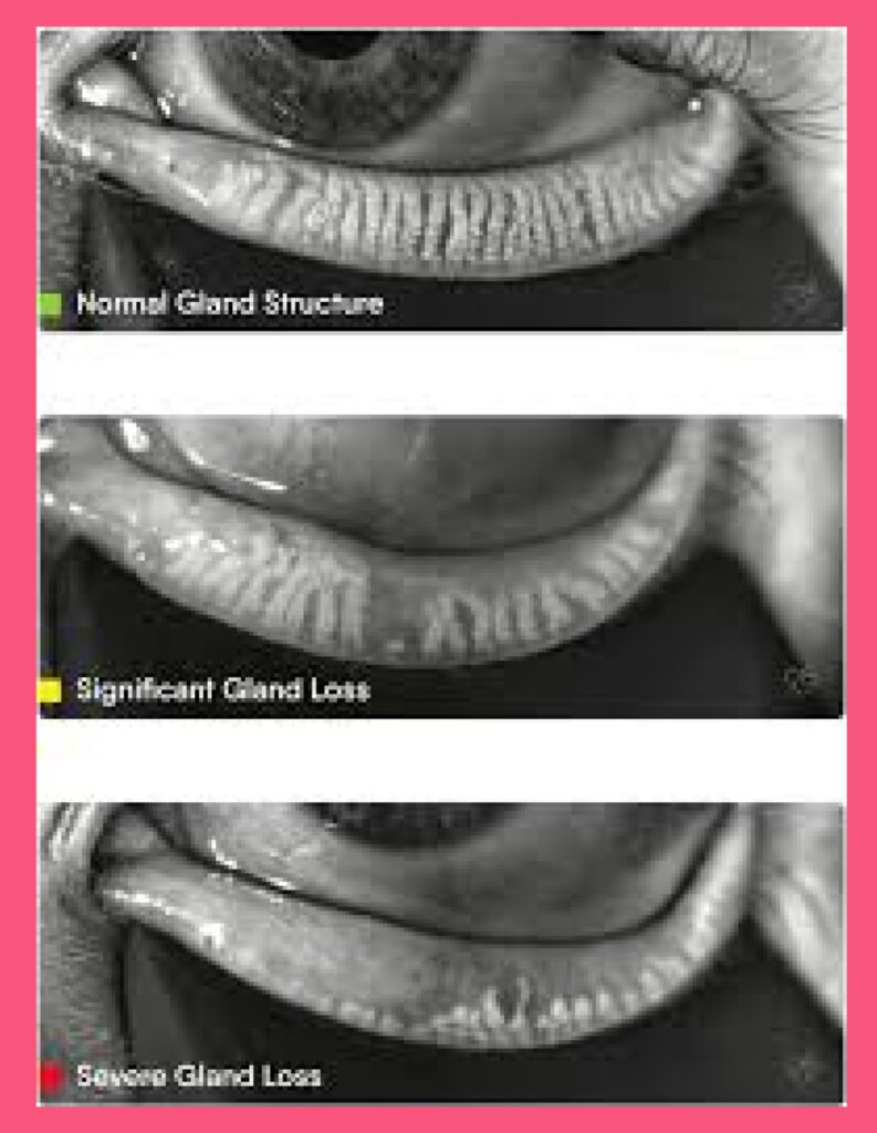 meibomian glands structure