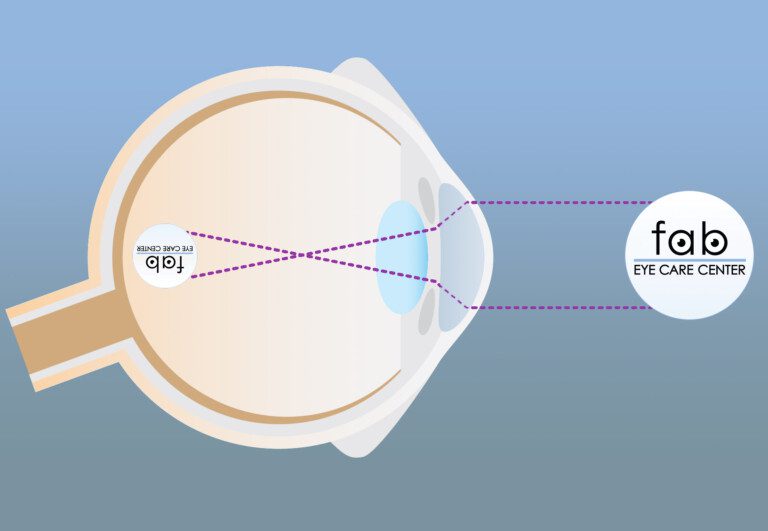 The Medical Myopia Management with Promising Outcomes